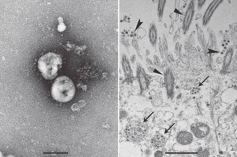 coronavirus 1
