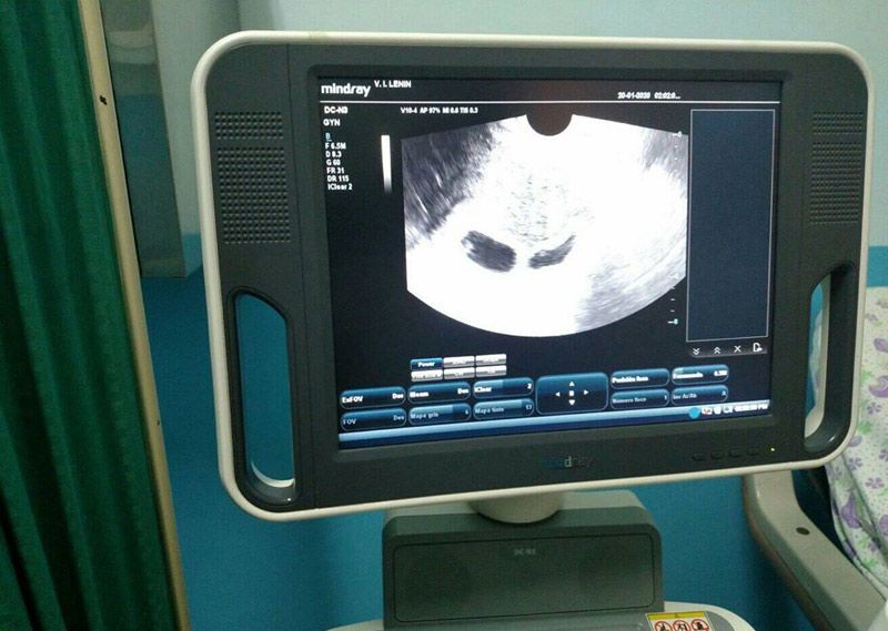 fertilizacion 1