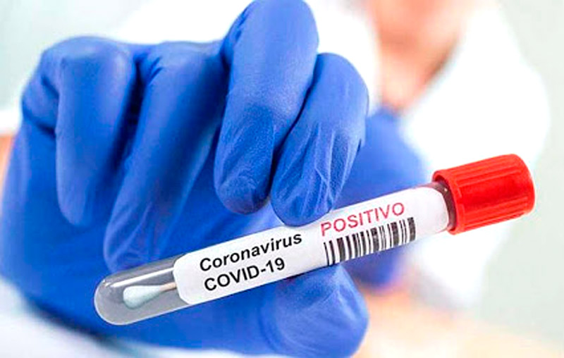 holguin coronavirus positivo