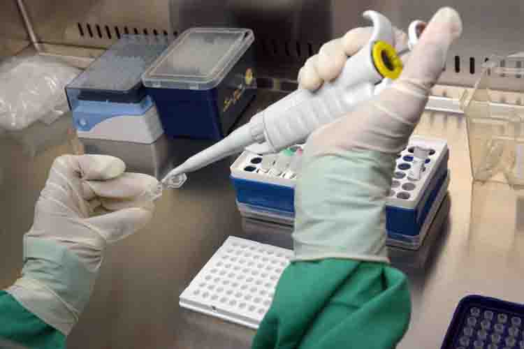 COVID laboratorio