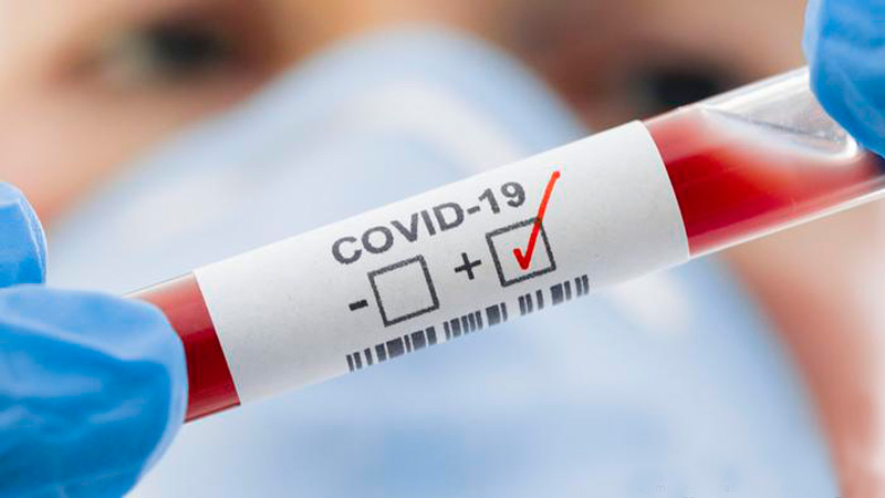 COVID 19 positivo test