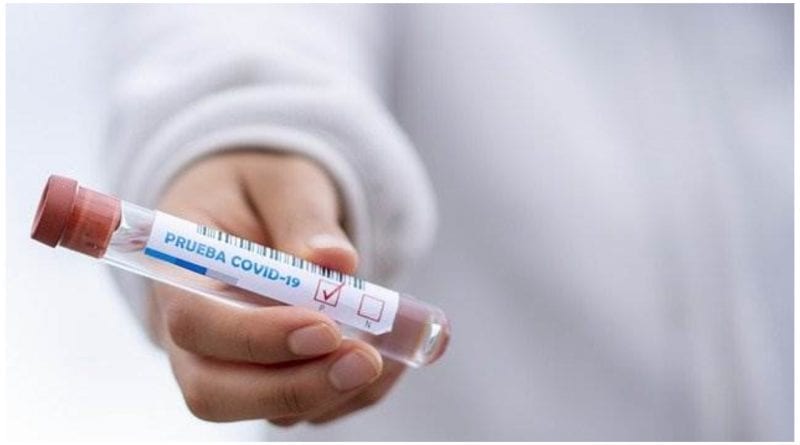 OVID 19 prueba