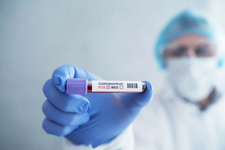 Coronavirus COVID 19 test