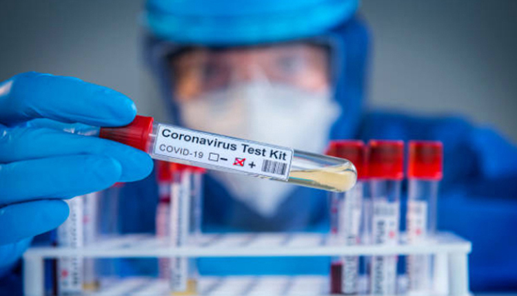 coronavirus test