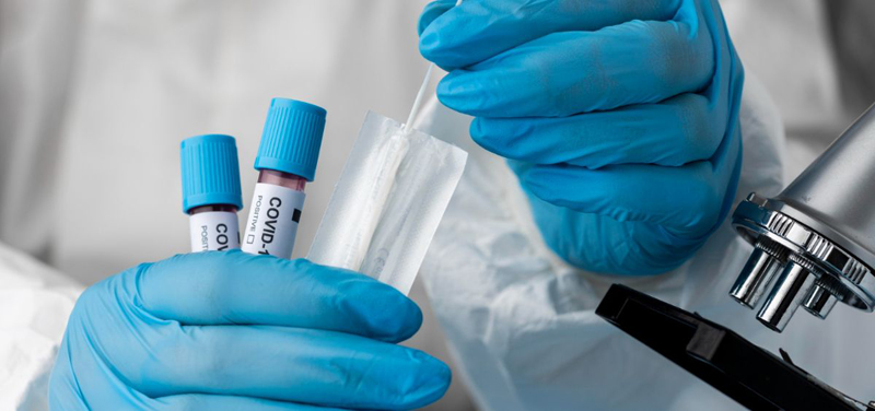 Covid laboratorio