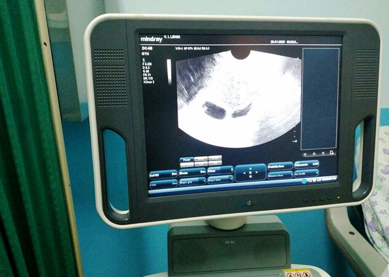 fertilizacion asistida f ah