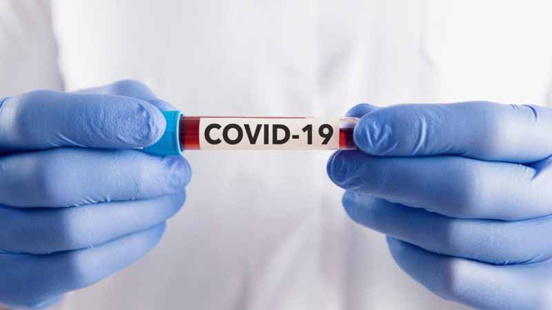 protocolo sanitario covid 19