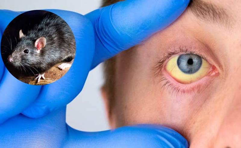 leptospirosis prevención