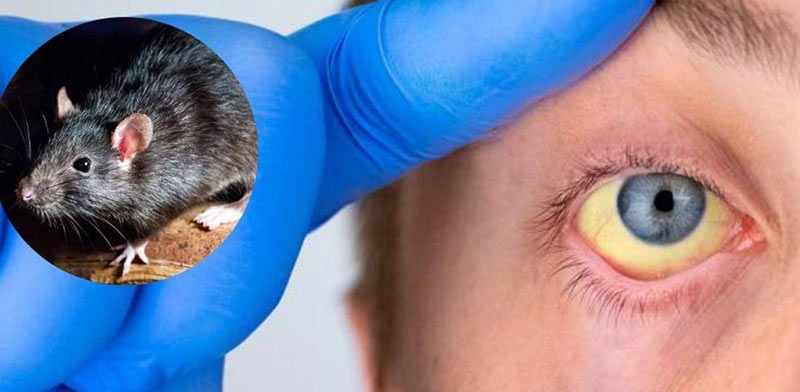 lluvias leptospirosis0