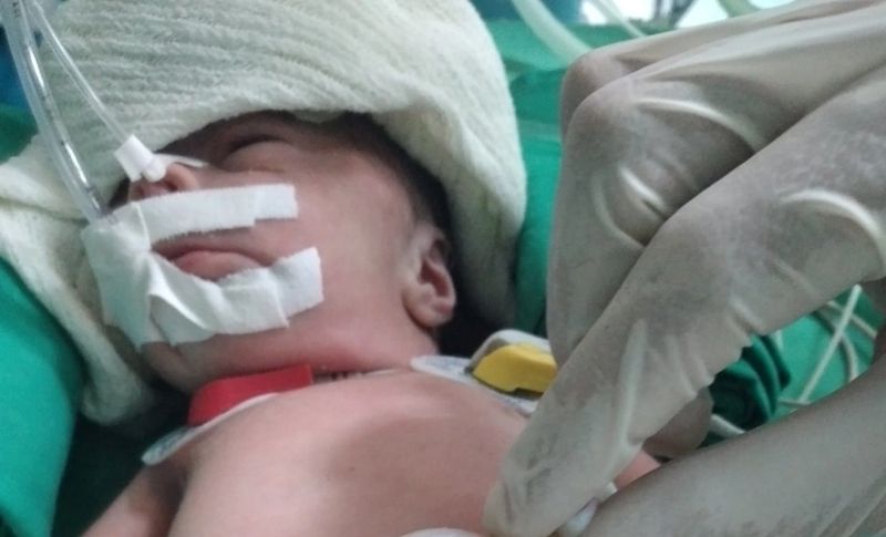 cirugia neonatal pediatrico holguin1