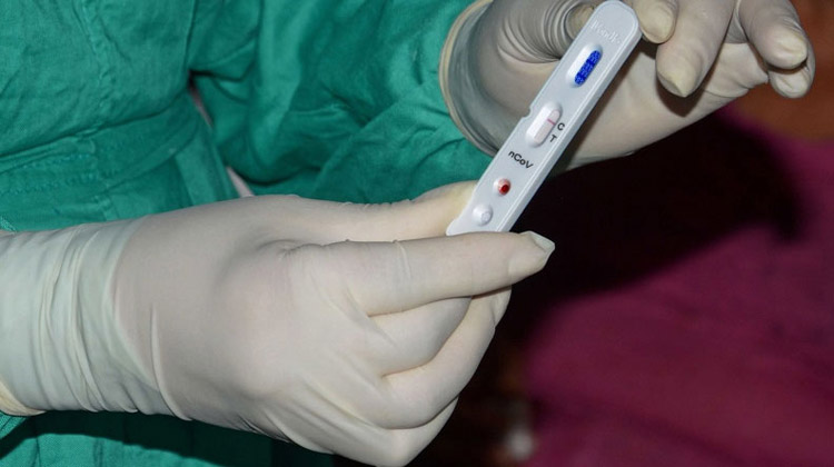 Foto: ACN coronavirus test 2