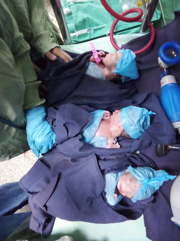 Uno de los últimos partos ocurridos en Hospital Lenin en diciembre de 2022, fue de trillizos, que hoy se mantienen en Servicio de Neonatología con los cuidados especiales requeridos. Foto: Cortesía del Hospital Lenin. Tasa de mortalidad infantil1